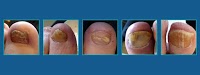 The London Nail Laser Clinic 698447 Image 0